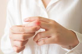 .sekitar pergelangan tangan?pangkal ibu jari?jari2 terasa kaku dan pegal?bhkan bkin sulit kerja yuk mengenal penyakit tangan yg sering bgt ditemui,mulai dari ibu rumah tangga,sampe org yg seharian kerja di depan komputer tenosynovitis /peradangan urat tangan.pic.twitter.com/jzwbnu5sul. Ketahui 4 Pemeriksaan Untuk Mendiagnosis Neuropati Radialis