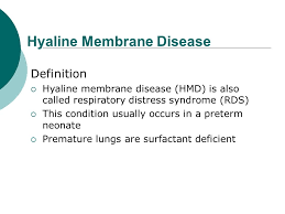 Respiratory Disorders Respiratory Disorders In The Newborn Perinatology Ppt Download