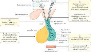 Diabetes Insipidus Nature Reviews Disease Primers