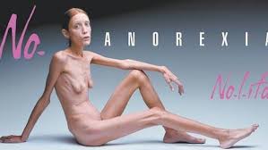 Resultado de imagen de anorexia idealizada