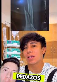 Accidente de Sonrixs: La verdad detrás de su lesión