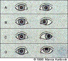 Pediatric Vision Screening For The Family Physician