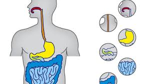 Bei erwachsenen liegt eine darmverstopfung laut medizinischer definition jedoch klar vor, wenn folgende symptome auftreten: á… Die Verdauung Das Kauen Von Nahrung Stellt Den Ersten Wichtigen Verdauungsschritt Dar