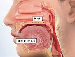 How do i know if i have hpv? Hpv And Throat Cancer Causes Symptoms And Treatment