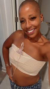 How to heal from a hematoma after explant and lift surgery?