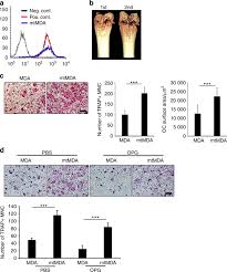Local recurrence is when the cancer returns to your breast, chest wall, or lymph nodes. S100a4 Released From Highly Bone Metastatic Breast Cancer Cells Plays A Critical Role In Osteolysis Bone Research