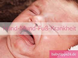 Hand Mund Fuss Krankheit Bei Babys Babytipps24 De