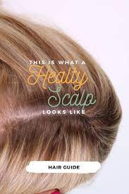 What Does A Healthy Scalp Look Like Healthy Scalp Healthy Hair Growth Healthy Hair