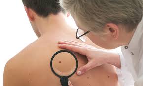Most people will discover one at some point, but fortunately, seattle skin and laser offers treatment options to safely and effectively remove these pesky skin blemishes. Best Guide To Cherry Angioma Removal Mvbotanicals Com