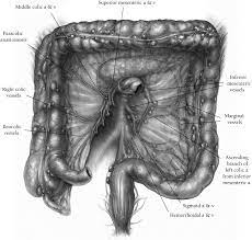 The anastomosis was sigmoidrectal in 7 patients and. Colonic Interposition For Benign Disease Operative Techniques In Thoracic And Cardiovascular Surgery