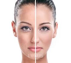 Salmon DNA Vaccine | Lygos Clinic