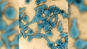 Marburg virus was first recognized in 1967, when outbreaks of hemorrhagic fever occurred simultaneously in laboratories in marburg and frankfurt, germany and in belgrade, yugoslavia (now. C5mndtgfj Ridm