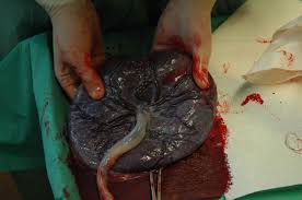 Resultado de imagem para imagens de placenta humana