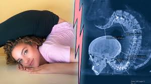 Does Sofie Dossi Have A Spine Yes Or No Answer The Shocking Truth About My Spine Part 2 Youtube