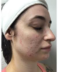 Melanie Costello (@mell_the_esthetician) • Instagram photos and videos