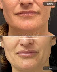 Faces Medspa and Givens MD Facial Plastic Surgery