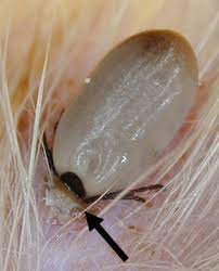 Tick Removal