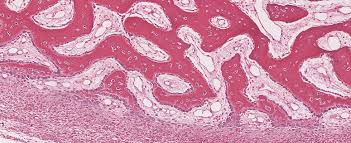 Macroscopic, histological, and radiological diagnosis of structural changes in the skeleton. Bone And Bone Formation Histology