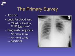 Check spelling or type a new query. Introduction To Trauma Erik G Van Eaton Md Assistant Professor Department Of Surgery Division Of Hmc Trauma Univ Of Washington Seattle Washington Erik Ppt Download