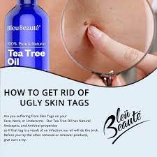 Bleubeaute Proven To Combat Acne Toenail Fungus Dandruff Skin Tags Cold Sores Lice Rin Essential Oils For Skin Skin Tags Essential Oils Skin Tag Removal