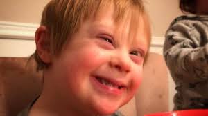 Mom, that boy said Judah looked weird.' I knew. I saw. I could feel the  little boy boring holes into my 4-year-old, who has Down syndrome.'