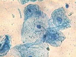 Epithelial cheek cells observed with tomographic diffractive. Which Of The Following Is The Diagram Of Human Cheek Cell