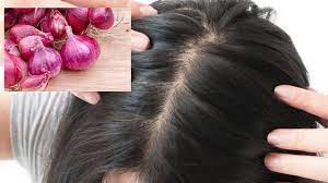 Kelemumur, serpihan putih yang sedikit menjengkelkan yang terkumpul di rambut, boleh menjadi keadaan yang memalukan, tetapi ketahuilah bahawa mungkin untuk menghilangkan kegusaran ini. Kelemumur Buat Anda Rasa Down 7 Bahan Ini Mampu Rawat Anda Sebelum Jadi Lebih Parah Pesona Pengantin