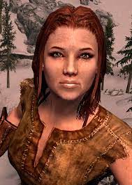 More Freckles By Zhoken At Skyrim Nexus Mods And Community Skyrim Nexus Mods Skyrim Tes Skyrim