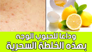 Maybe you would like to learn more about one of these? Ø®Ù„Ø·Ø© Ù„ØªØµÙÙŠØ© Ø§Ù„ÙˆØ¬Ù‡ Ù…Ù† Ø§Ù„Ø­Ø¨ÙˆØ¨ ÙÙŠ Ø£Ø³Ø¨ÙˆØ¹
