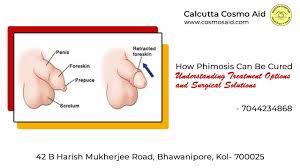 Image result for Phimosis