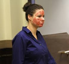 Image result for Dissotis trothae