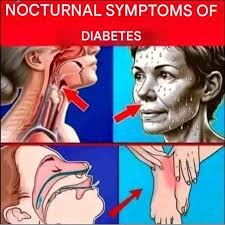 Signs That You Have Too Much Sugar in Your Blood Full recipe in 💬 👇