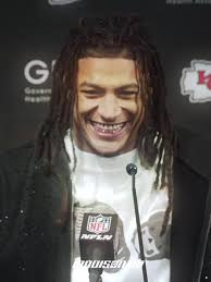 Isiah Pacheco's Smile Transformation Revealed