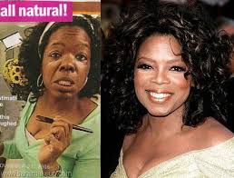 Genuine Black And White Bleaching Cream Before And After Black Skin Aging Looks Different Part Ii Focus Sun Damage Beyond Black White Black Skin Aging Skin Celebs Without Makeup