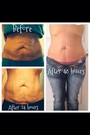 Need Help To Tighten Up That Loose Skin After Losing Weight It Works Wraps Can Help You Tighten And Tone It Vi Skin Tightening Stomach Saggy Skin Loose Skin