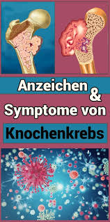 Pin Auf Fitness