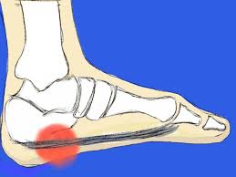 Pin On Foot Heel Health