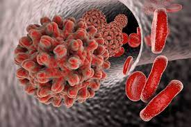 What Is Viral Infection Know Its Types Causes And Treatments