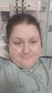 What helps with prednisone swelling?