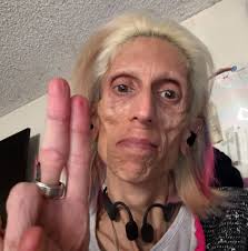 Rachael gives her recovery update after her IVC filter removal. It's been a  rocky road lately that we are hoping to smooth out. Thank you for all of  the love and ongoing