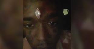 Lil uzi vert has revealed the new pink diamond he's embedded into his forehead costing $24 million. S48wysowkvatjm