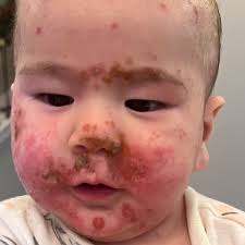 Fundraiser by Gina Florio : Give Baby Vincent a Chance at a Healthy Future