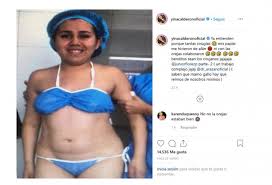 La famosa ex protagonista de novela yina calderón es reconocida por sus múltiples cirugías, las cuales han producido un cambio extremos en su rostro. Yina Calderon Asi Era Antes De Las Cirugias Plasticas Alerta Bogota