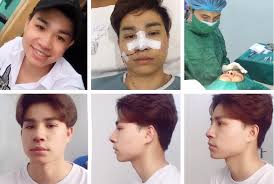 Ngành kỹ thuật công nghiệp. Cháº³ng Rieng Ä'á»©c Phuc Nhiá»u Sao Viá»‡t Sau Pháº«u Thuáº­t Tháº©m Má»¹ CÅ©ng Lá»™t Xac Ngá»¡ Ngang Viá»‡t Nam Má»›i