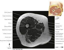It is best studied broken down into its components: Lower Limbs Radiology Key