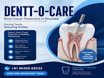Best Root Canal Treatment in Roorkee product image