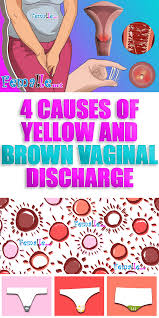 Early on, typically no symptoms are seen. Pin On Remedies