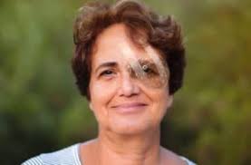 10/47 eyes developed a visual acuity impairing cataract during follow up.: Katarakt Cerrahisinde Iyilesme Suresini Kisaltmak Icin 8 Oneri