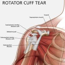 Tutorials on the shoulder muscles (e.g rotator cuff muscles: A Smart Patch That Promotes Shoulder Repair Www Oxfordsparks Ox Ac Uk