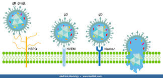 Image result for Acute Labyrinthitis